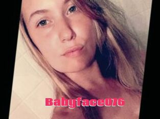 Babyface076